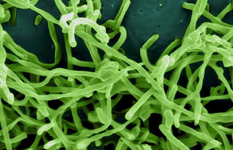 Photo of the ebola virus