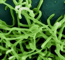 Photo of the Ebola virus